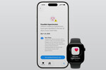 Apple Watch Series 11