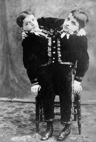 <b>Джованни и Джакомо Токки</b>
<br><br>
Джованни и Джакомо Токки родились между&nbsp;1875 и 1877&nbsp;годами в&nbsp;Италии. Близнецы были дицефалами, то есть имели одно туловище и две головы, а также две пары рук. Уже в&nbsp;раннем возрасте они начали выступать в&nbsp;цирке, их родители при&nbsp;этом не разрешали врачам обследовать мальчиков, боясь, что это умалит их славу. В&nbsp;1891 году они отправились в&nbsp;США на&nbsp;гастроли, которые в&nbsp;итоге вылились в&nbsp;пятилетнее турне из-за популярности братьев. Именно в&nbsp;этот период их фотография попалась Марку Твену, и, вдохновившись снимком, он создал рассказ «Эти необыкновенные близнецы» (1892), который позже стал романом «Простофиля Уилсон» (1894). В&nbsp;1897 году Джованни и Джакомо решили уйти на&nbsp;пенсию и стали вести затворническую жизнь на&nbsp;вилле в&nbsp;Венеции. В&nbsp;1904-м братья женились на&nbsp;двух женщинах. По&nbsp;некоторым данным, позже они также завели детей. Однако другие сообщения утверждали, что близнецы умерли бездетными в&nbsp;1940-м.
<br><br>
<b>На фото:</b> братья Точчи на&nbsp;визитной карточке, 1880-е гг.