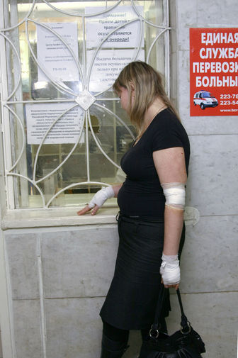 Пострадавшая от взрывной волны после падения метеорита в травмпункте города Челябинска